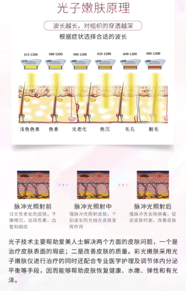 奢已m22光子嫩肤 光子10次卡