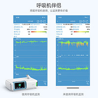 乐普 血氧仪 CheckmeO2