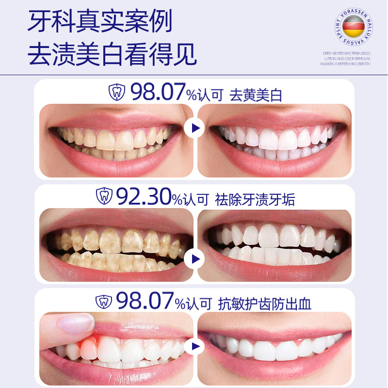 沃朗森牙膏去黄去口臭美白溶解牙结石速效洗白脱抗敏