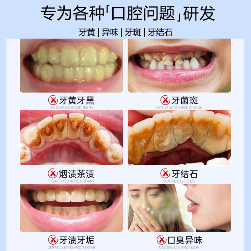 洁牙粉去黄洗白去口臭黄牙齿结石污垢牙渍牙垢清洁非美白男女