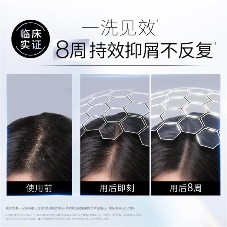 净屑调理洗发露460ml去屑舒缓调理洗发水