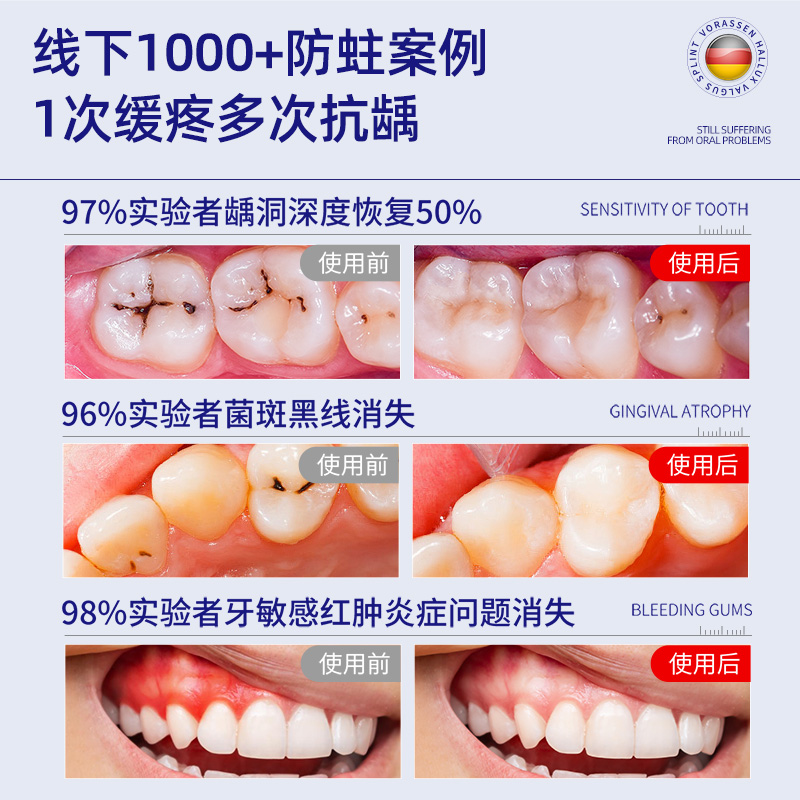 沃朗森非牙膏含氟成人防蛀牙龋齿修复去黄口臭抗敏感医用