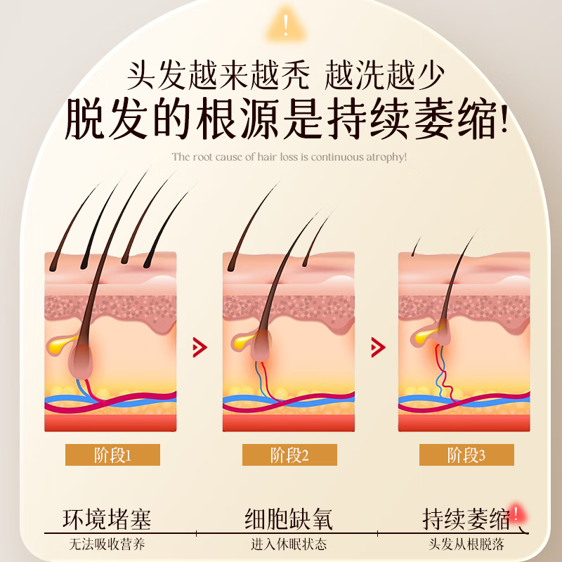 卡伦雅芙官方卡伦雅芙防脱洗发水生姜何首乌侧柏叶固定发根防脱 控油蓬松500ml*2瓶