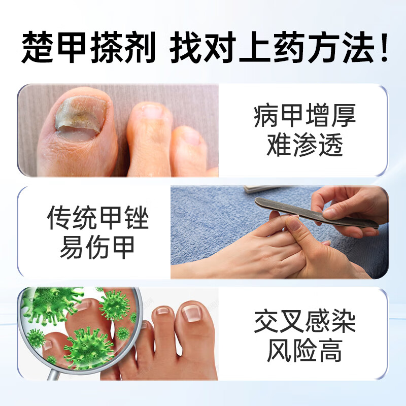  楚甲 灰指甲 电动磨甲器  1件