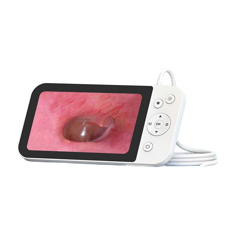 泰视朗（Teslong）智能带屏可视挖耳勺专业采耳店用工具套装硅胶掏耳棒高清耳镜 MS500