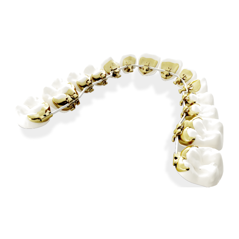 马泷齿科eBrace舌侧矫正套餐