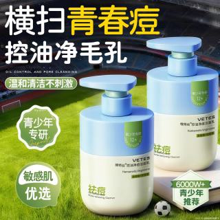 Vetes 氨基酸青少年洗面奶男女控油祛痘去黑头12-18岁学生期儿童洁面乳