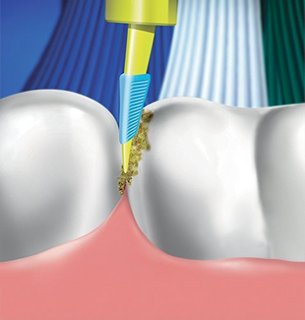 BRAUN 博朗 Oral-B 欧乐-B Professional Deep Sweep 5000 D345655XP 声波电动牙刷