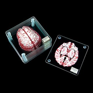 ThinkGeek Brain Specimen Coasters 脑部切片杯垫