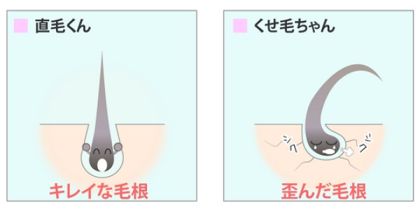 自来卷宝宝不哭！垂顺秀发指日可待