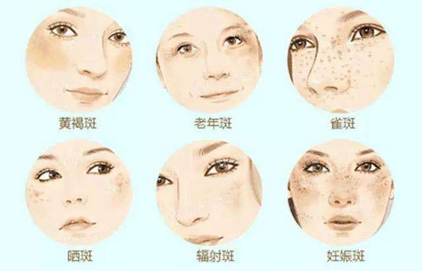 贝窝热卖VOL.48:女人让自己早点“下斑”