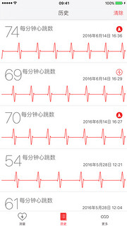  《Cardiograph（心电图仪）》iOS应用软件