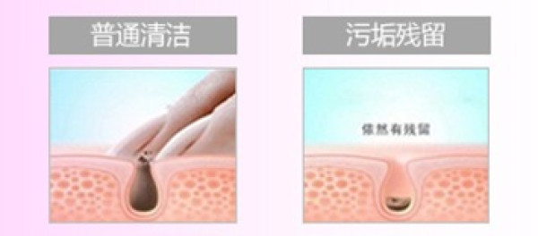 贝窝热卖:面子别人给 脸得靠自己保养