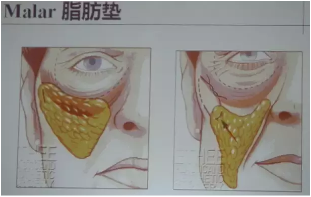 抗衰老的新思路 和我用过的护肤推荐