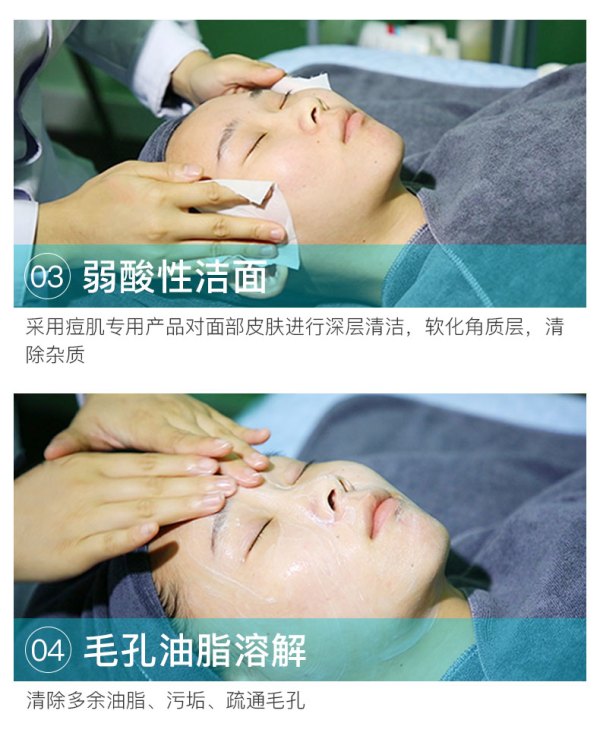 科痘 痘肌清洁补水2次