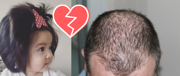  7个月大的她，头发比你更浓密助宝宝一头好发的必备好物