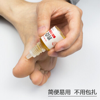 力仕康鸡眼抑菌液10ml（鸡眼）老茧跖疣寻常疣湿疣脚垫趾疣肉刺贴鸡眼贴膏扁平疣非去除药