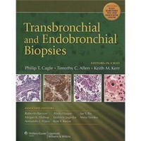Transbronchial and Endobronchial Biopsies[支气管活检]