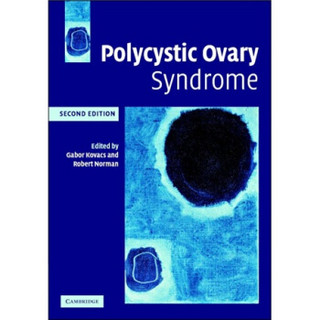 Polycystic Ovary Syndrome[多囊卵巢综合症]