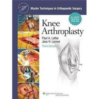 Master Techniques in Orthopaedic Surgery: Knee Arthroplasty[掌握骨外科手术技巧：膝关节形成术]