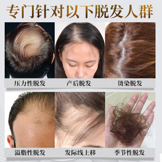 艾君防脱发育发洗发水800ml 男女断发固发生姜洗发水老姜王增发密发洗发露