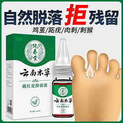 云南本草鸡眼膏去手足部脚底瘊子除老茧肉刺根脚趾疣去疣灵鸡眼贴