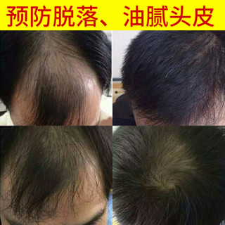 发觉（fajue） 发觉泛华植物控油防脱育发洗发水男士女士洗发露洗护套装 防脱发健发密发育发