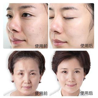 eto/医朵V脸面膜 提拉紧致皮肤 淡化脸部肌肤细纹法令纹 面膜