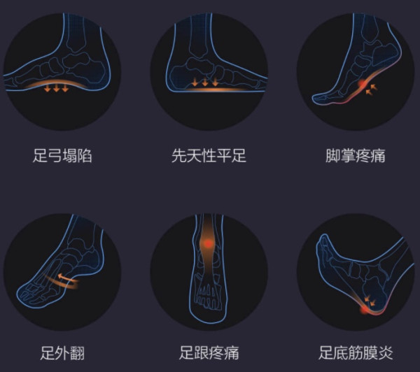 小编精选、新品发售:Senthmetic 芯迈 三分钟快速定制鞋垫 2双