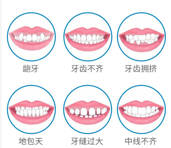 爱康国宾齿科 时代天使正畸套餐牙齿矫正