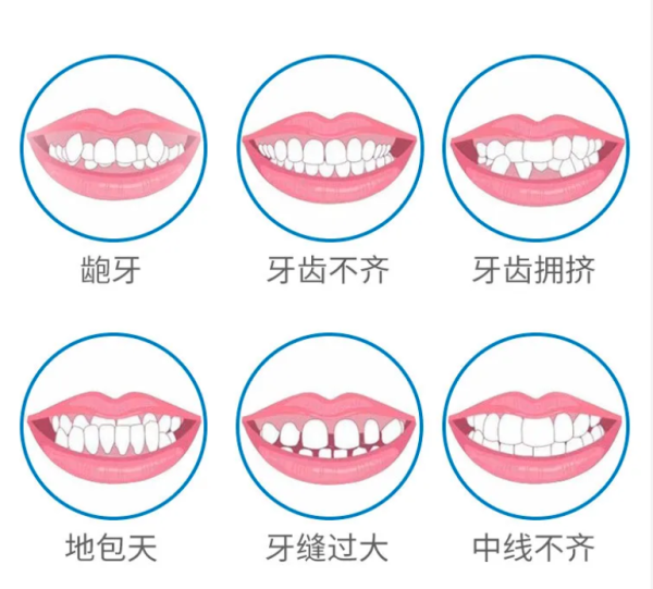爱康国宾齿科 时代天使正畸套餐牙齿矫正