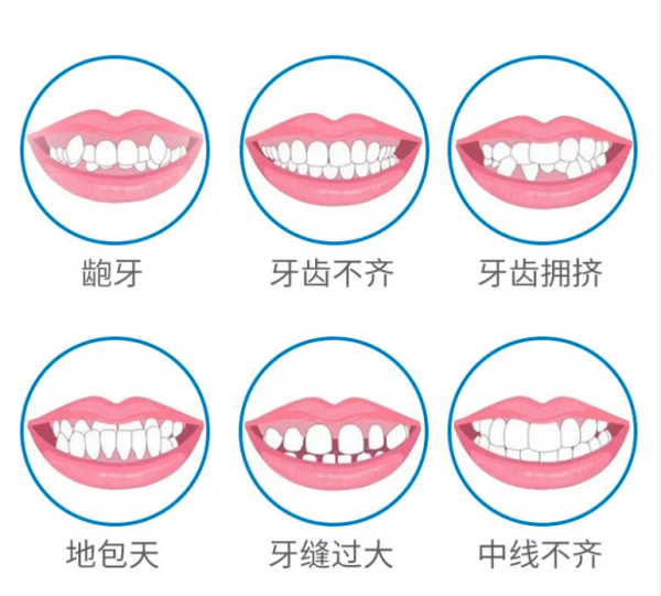 爱康国宾齿科  时代天使正畸套餐牙齿矫正