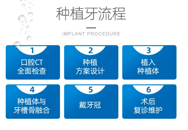 美奥口腔 ITI种植牙 瑞士进口 口腔齿科 植体+基台+全瓷牙冠 ITI种植+全瓷牙冠