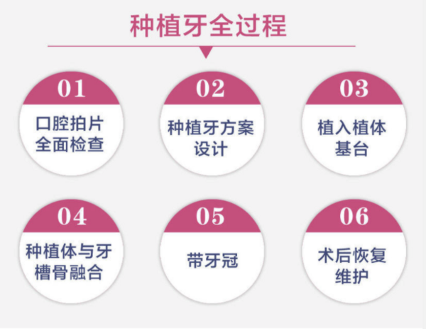 彩虹医生  半口/全口固定种植牙 每半口6颗种植体12颗全瓷牙冠 金属基台