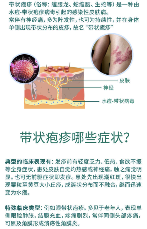 悦苗 带状疱疹疫苗(生蛇) 2针 50岁以上适用 代订服务套餐 多城市预约