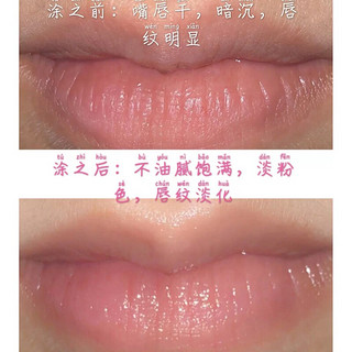 肌肤之钥 Cle de Peau）唇部精华乳15ml淡化唇纹润唇 15ml