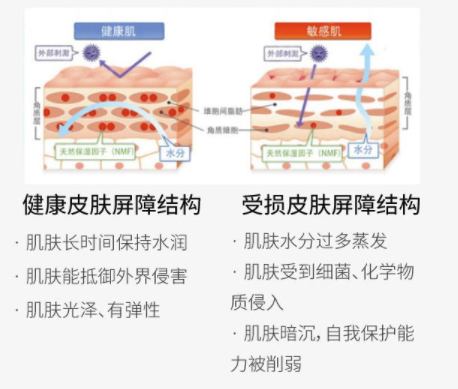 奢已 舒敏之星 全面部1次