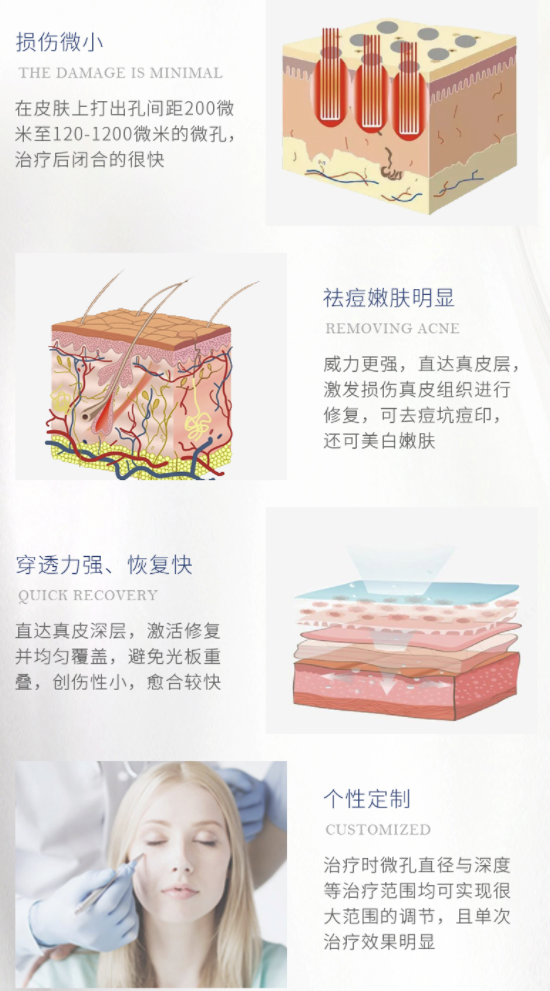 奢己  CO2二氧化碳剥脱点阵激光 