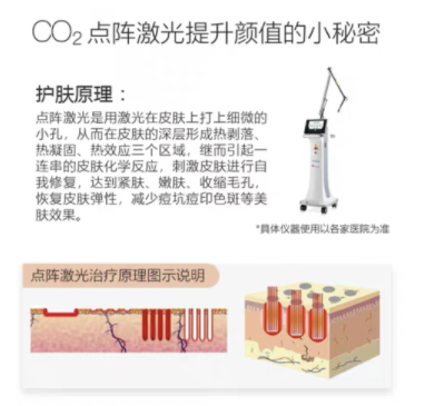 奢己 CO2二氧化碳剥脱点阵激光 