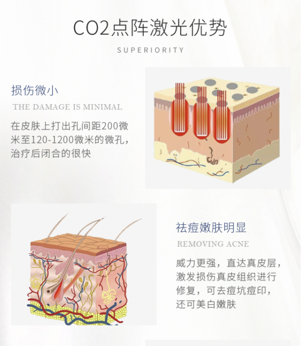 奢已 CO2二氧化碳剥脱点阵激光 非剥脱 限首单  