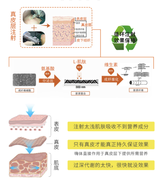 奢己 嗨体去颈纹/水光针 除皱抗衰 