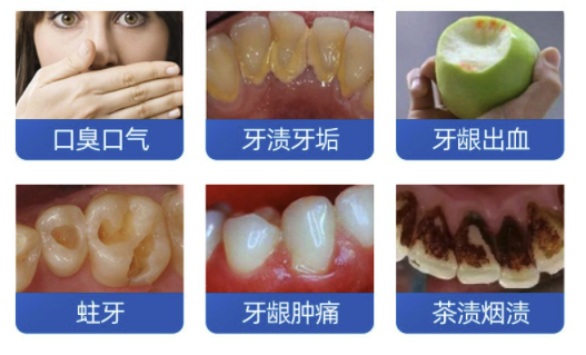 美奥口腔 超声波洗牙卡套餐洁牙+抛光