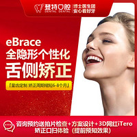 登特口腔 eBrace隐形个性化舌侧矫正牙套