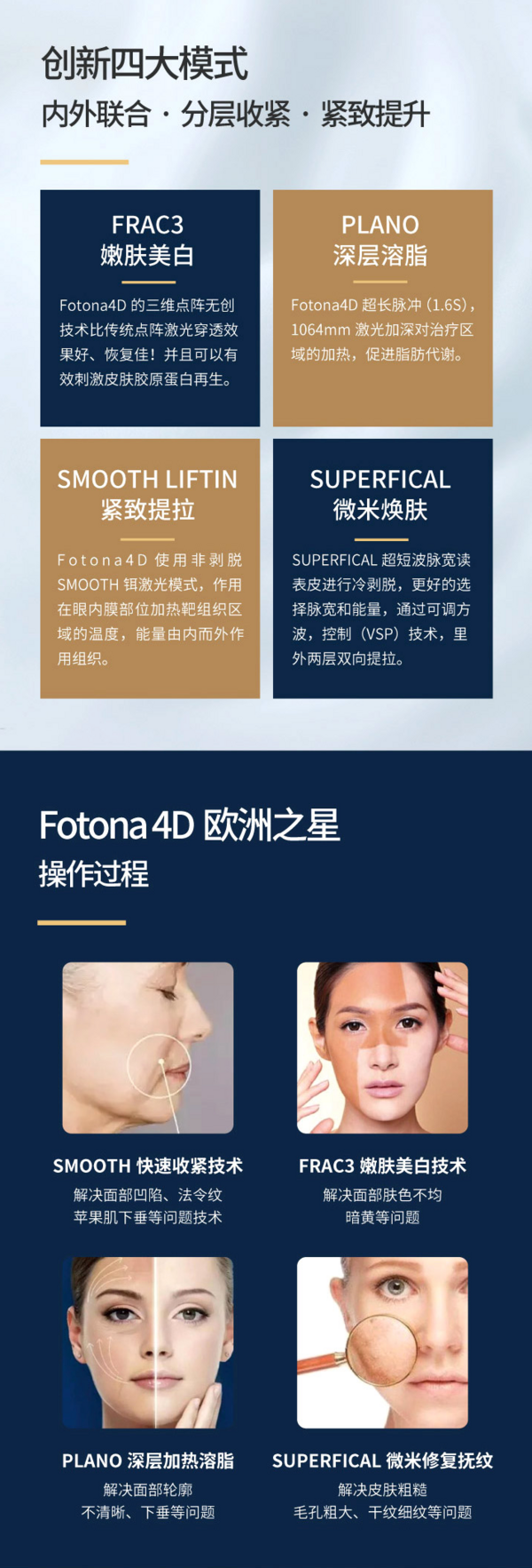 欧洲之星4D 全面部提拉3次