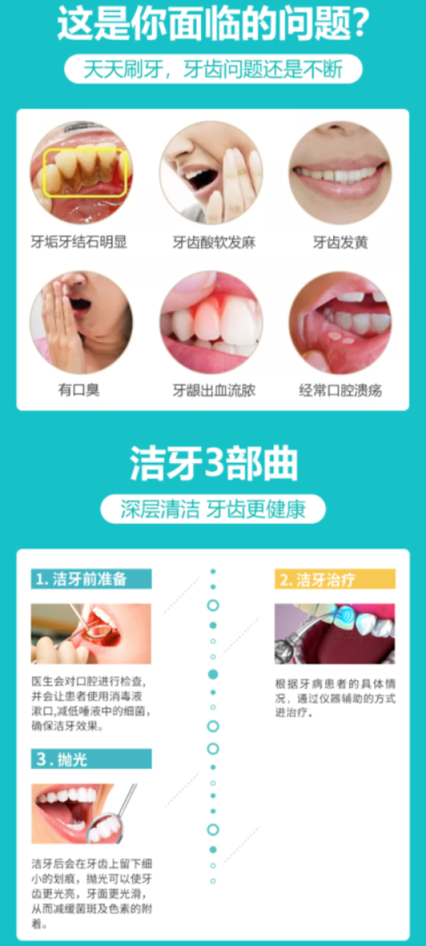 全家福口腔 超声波洁牙多少钱-什么值得买