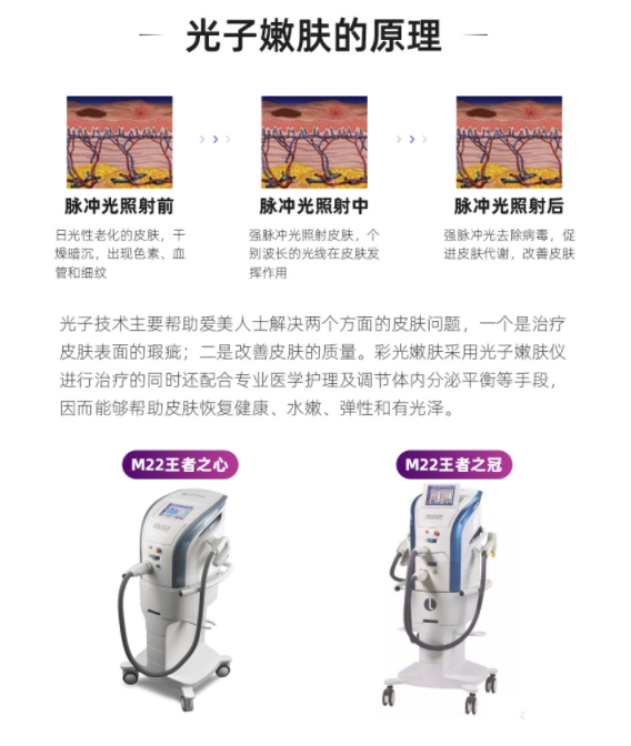M22新一代光子嫩肤全模式