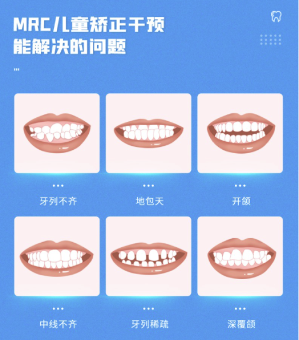 美奥口腔 儿童矫正MRC 早期矫正器干预系统一期