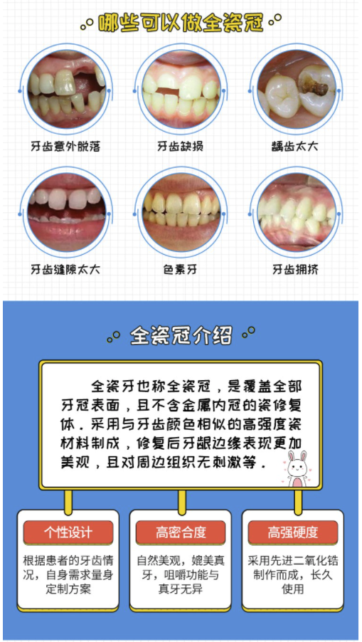 牙冠的种类及价格图片