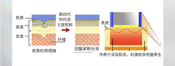 奢己 热玛吉4代 600发 面部颈部眼部提升