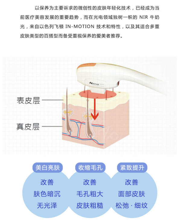 奢己 NIR牛奶光 激光嫩肤